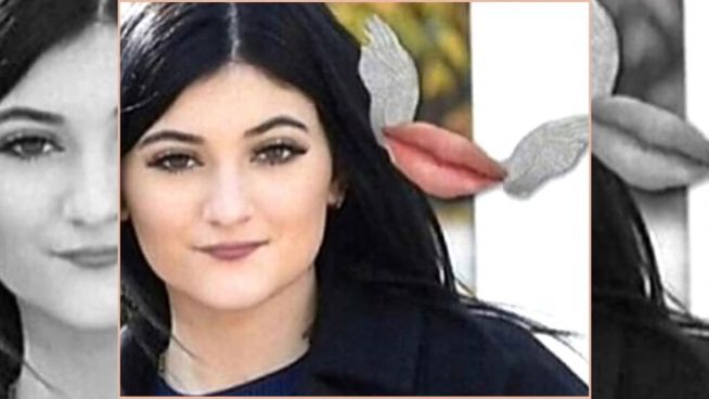 Kylie Jenner: Abschied von den schmalen Lippen